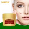 Face Cream Scar Removal Acne Treatment Repairing