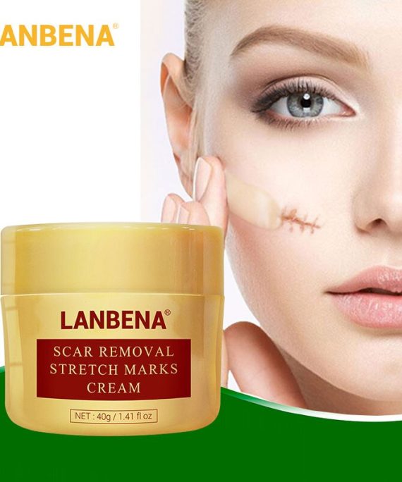 Face Cream Scar Removal Acne Treatment Repairing