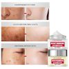 Face Moisturizing Repairing Skin Diminishing Spots