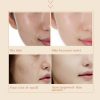 Face Skin Care Day Night Snail Cream Brightening Anti Acne