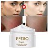 Face Skin Care Day Night Snail Cream Brightening Anti Acne