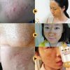 Deep Cleansing Honey Peel-Off Mask for Oil Control and Blackhead Removal