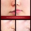 Natural Herbal Face Cream Moisturizer Anti Wrinkle Aging
