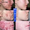 Plant Extract Tea Tree Cleansing Face Anti Acne Cream