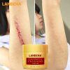 Scar Removal Cream Acne Treatment Repairing Scar Pigmentation