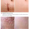VIBRANT GLAMOUR Crocodile Face Toner – Acne Scar Repair, Pore Refining, and Skin Brightening Serum (30ml) ✨