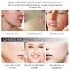Vibrant Glamour Verbenone Rosemary Gel Acne Face Cream