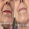 Retinol Cream for Face and Eye - Night Facial Cream Moisturizer