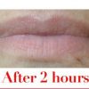 Fullips Lip Plumping Tool -Small Oval Plus