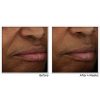 RoC Multi Correxion Revive + Glow Vitamin C Moisturizer for Face