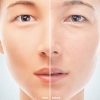 Hopemate Natural Facial Vitamin C Serum with Hyaluronic Acid& Vit E