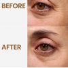 HOPEMATE Natural Facial Retinol Serum with Hyaluronic Acid& Vitamin E