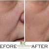 Vitamin C Serum for Face - with Vitamin E, Hyaluronic Acid and Aloe