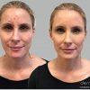 Waterproof Concealer Cream, Full Coverage Waterproof Makeup