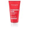 Neutrogena Stubborn Acne AM Face Treatment with Benzoyl Peroxide
