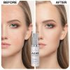 Benzoyl Peroxide Face & Body Acne Spot Treatment