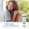 Gold Bond Dark Spot Minimizing Cream, 2 Ounce