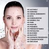 Iryasa Facial Mist Spray - Hydrating Face Mist Spray with Chamomile