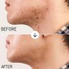 Concealer Stick with Sponge Applicator for Men and Women