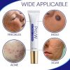 Blemish Treatment for Face, Blackhead Removal Cream, Anti Aging Skin Clearing Cream, Wrinkle, Cystic Acne, Fine Line, Pigmentation, Pore Minimizer & Dark Spot Corrector for Face