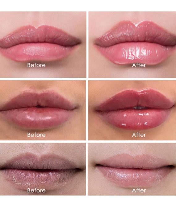 Aliver Lip Plumper Kit, Natural Lip Plumper Gloss and Lip Care Serum, Lip Gloss Lip Enhancer for Fuller, Lip Plumping Balm, Hydrating and Reduce Fine Lines