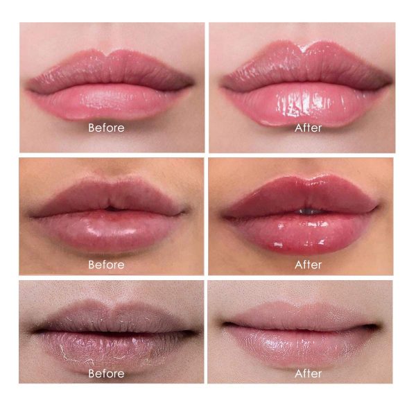 Aliver Lip Plumper Kit, Natural Lip Plumper Gloss and Lip Care Serum, Lip Gloss Lip Enhancer for Fuller, Lip Plumping Balm, Hydrating and Reduce Fine Lines