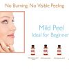 60% Gel Peel Including After Peel Neutralizer Facial Peel