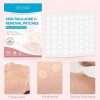 Acne Pimple Healing Patches for Face and Body