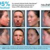 Acne Prone Skin with 2% Salicylic Acid + 1% Mandelic Acid