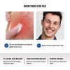 Acne Spot Treatment for Acne Prone Skin Premium Tea Tree Oil
