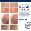 Old and New Scars Remover Gel for Scars from C-Section