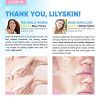 Alpha-Arbutin & Hyaluronic Acid Cream Natural Dark Spot Remover
