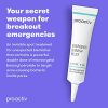 Acne Spot Treatment For Face and Body