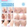 Alpha-Arbutin & Hyaluronic Acid Cream Natural Dark Spot Remover