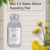 70% Glycolic Acid Peel Peel Neutralizer Wrinkles, Age Spots