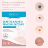 Acne Pimple Healing Patches for Face and Body
