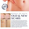 Old and New Scars Remover Gel for Scars from C-Section