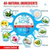Natural Acne Scar Remover Cleanser
