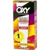 Maximum Action Spot Treatment