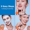 Acne Free Sulfur Mask for Clearing Acne