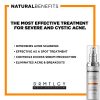 Spot Treatment and Cystic Acne Treatment Peroxide 5% and Glycolic Acid