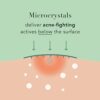 Rael Acne Pimple Healing Patch - Microneedle Acne Spot, Absorbing Cover