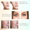 Radio Frequency Skin Tightening, MLAY RF Radio Frequency Lifting
