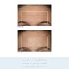 NuFACE Anniversary Complete Facial Toning Kit | Trinity Facial Device