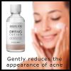 Majestic Pure Acne Drying Lotion, Acne and Pimples Skin Care Formula