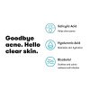 Proactiv+ Acne Moisturizer - Hydrating Face Moisturizer with Salicylic Acid