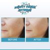 Anti Aging Resurfacing Chemical Peel Pads- Contains Lactic Acid