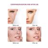 Blackhead Remover Pore Vacuum, Electric Skin Facial Pore Cleanser