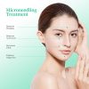 Derma Roller Cosmetic Microdermabrasion Instrument for Face