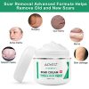 Scar Removal Cream, Advanced Acne Marks Treatment, Face and Body Skin